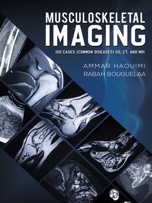 cover image of Musculoskeletal Imaging